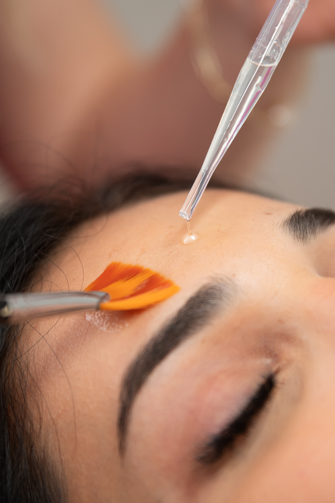 Mesopeel MD Mandelic 30%